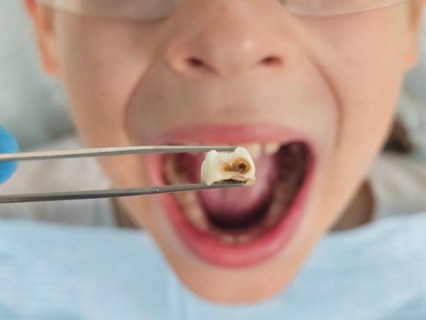 Best Knocked-Out Tooth Emergency  in Chaska, MN